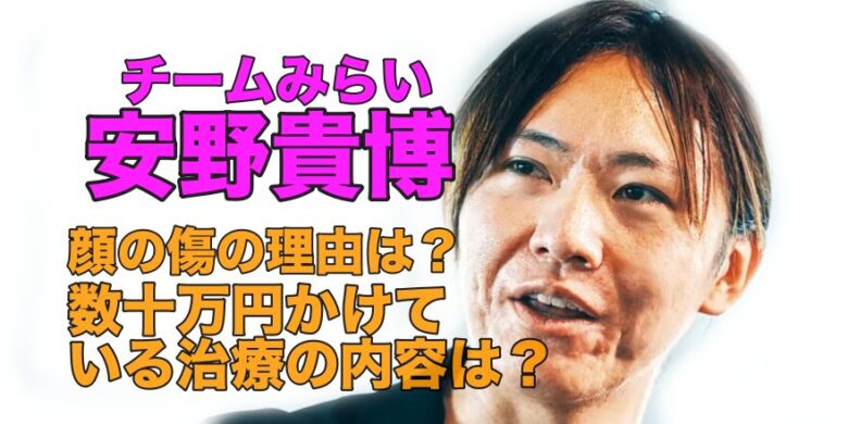 安野貴博の顔の傷は怪我？数十万円かけている治療とは？